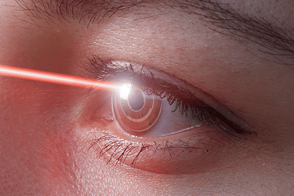 chirurgie refractive lyon dr arthus drevon chirurgie ophtalmologique lyon chirurgie refractive surface oculaire