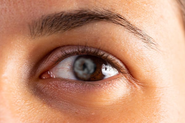 avis prelex dr arthus drevon chirurgie ophtalmologique lyon chirurgie refractive chirurgie de la cataracte surface oculaire