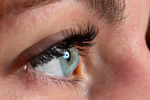 keratocone anneaux intra corneens dr arthus drevon chirurgie ophtalmologique lyon chirurgie refractive chirurgie de la cataracte surface oculaire