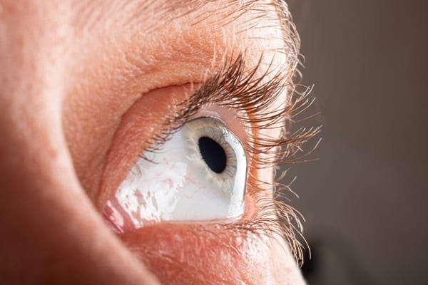 keratocone cross linking prix dr arthus drevon chirurgie ophtalmologique lyon chirurgie refractive chirurgie de la cataracte surface oculaire