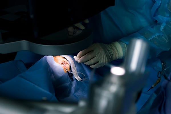 laser excimer avis mel 90 dr arthus drevon chirurgie ophtalmologique lyon chirurgie refractive chirurgie de la cataracte surface oculaire