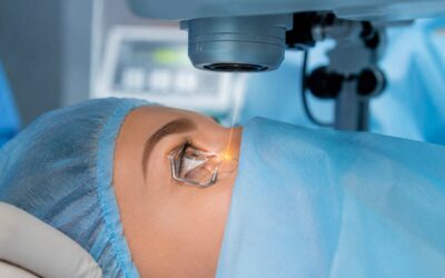 PKR ou LASIK : comment choisir ?
